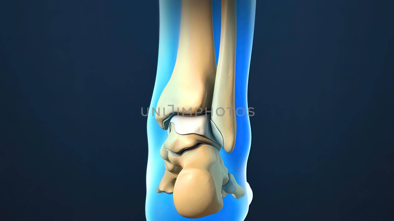 3D Render of Ankle Joint Anatomy and Osteoarthritis.The ankle is where the long tibia and fibula bones of the shin meet with the foot s talus bone.