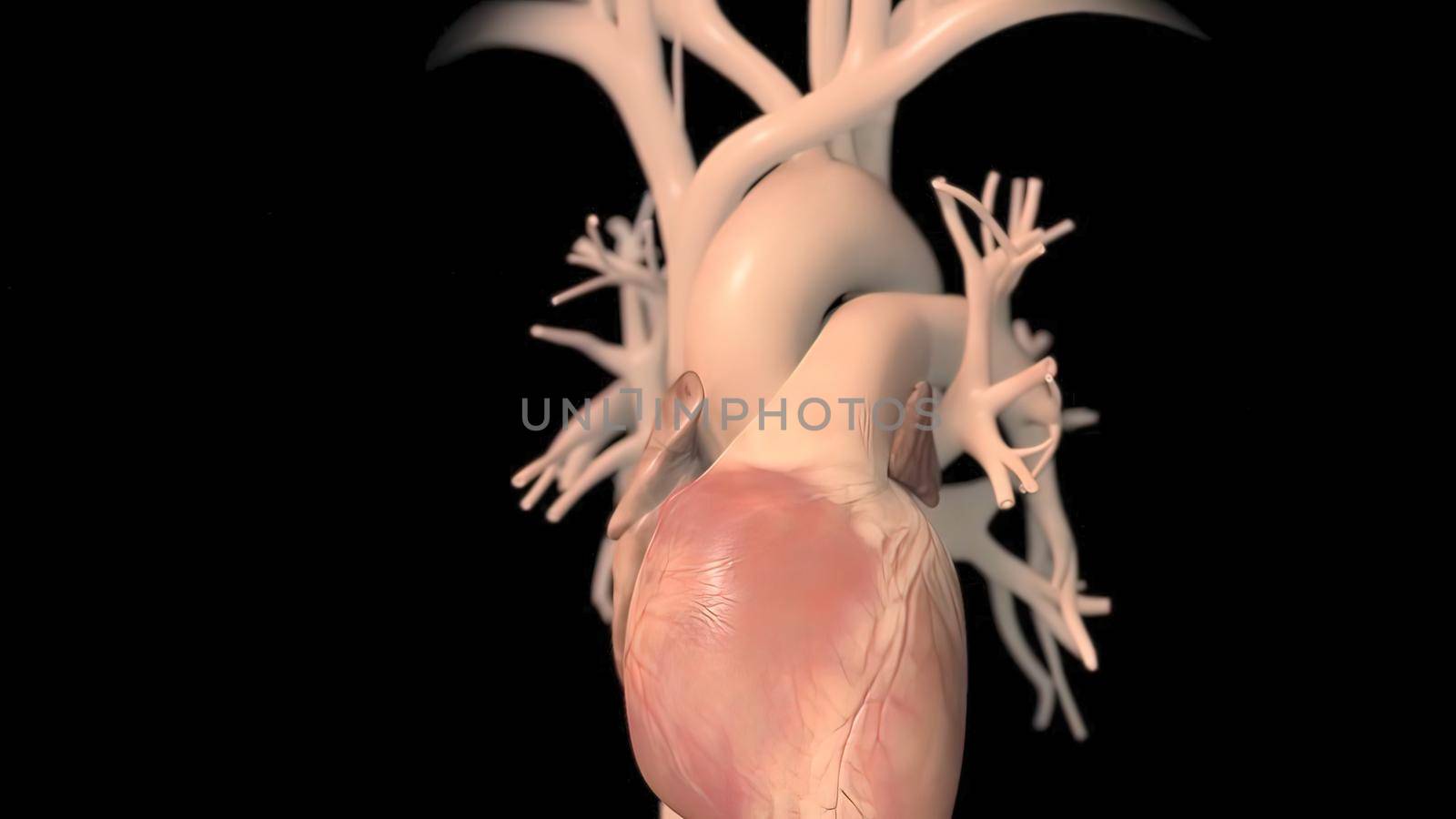 Coronary artery bypass surgery is done using a healthy blood vessel called a graft. by creativepic