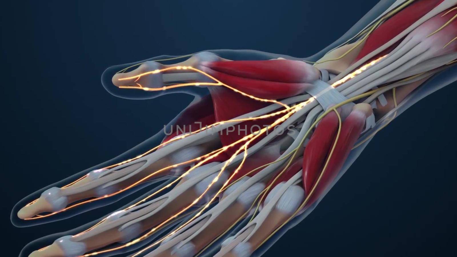 Carpal tunnel syndrome (CTS), numbness, tingling and pain condition in wrist by creativepic