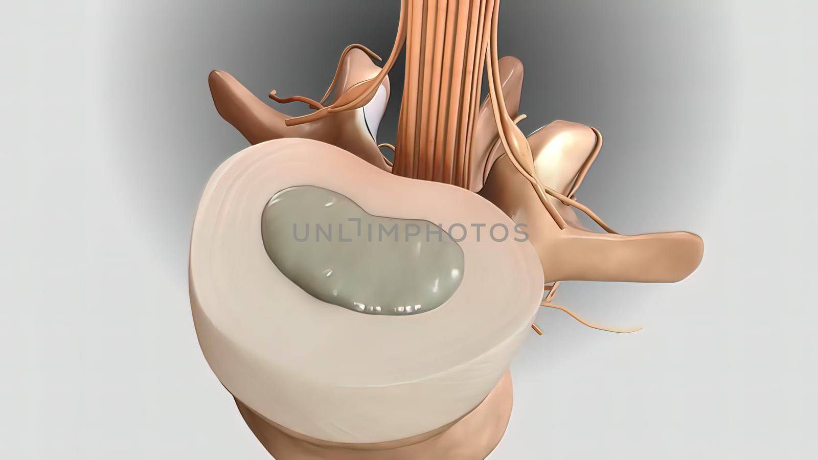 Cervical spine .Chronic Low Back Pain. 3D illustration