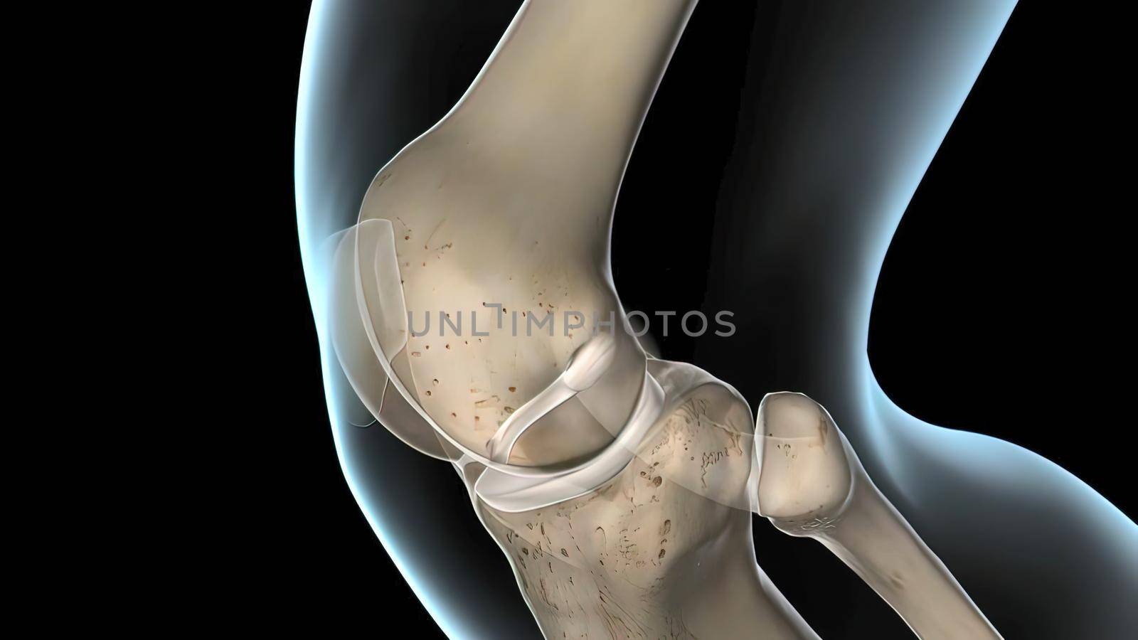 anterior cruciate ligament, the knee joint by creativepic