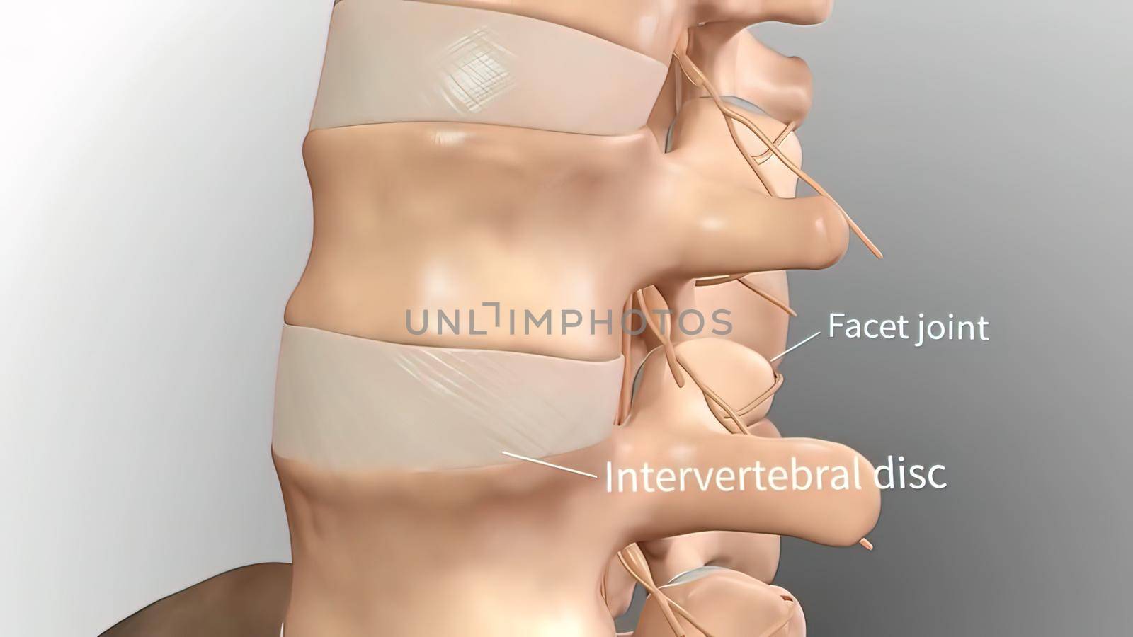 Chronic Low Back Pain. showing pain in the lower back 3D illustration