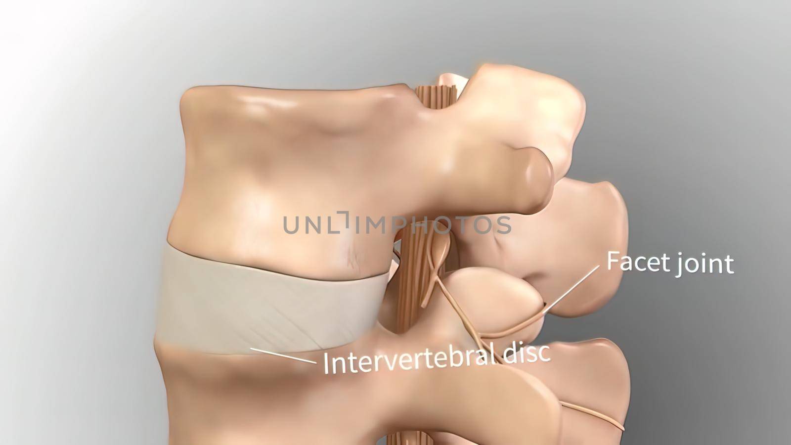 Chronic Low Back Pain. showing pain in the lower back 3D illustration