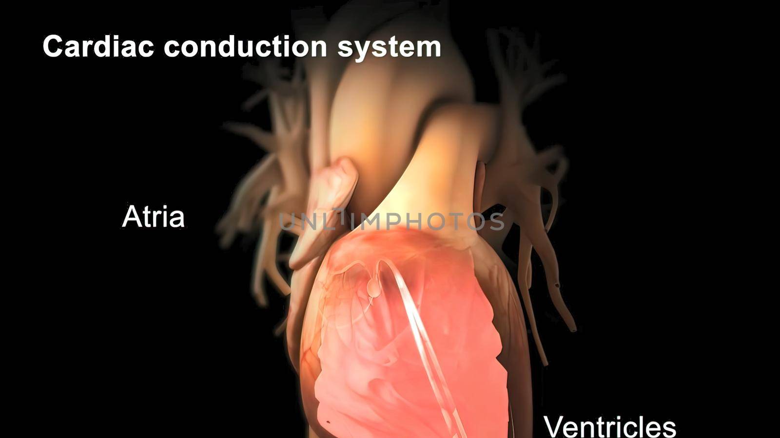 The pacemaker tissue in the right atrium of the heart. It provides the output of the normal sinus rhythm. 3D illustration