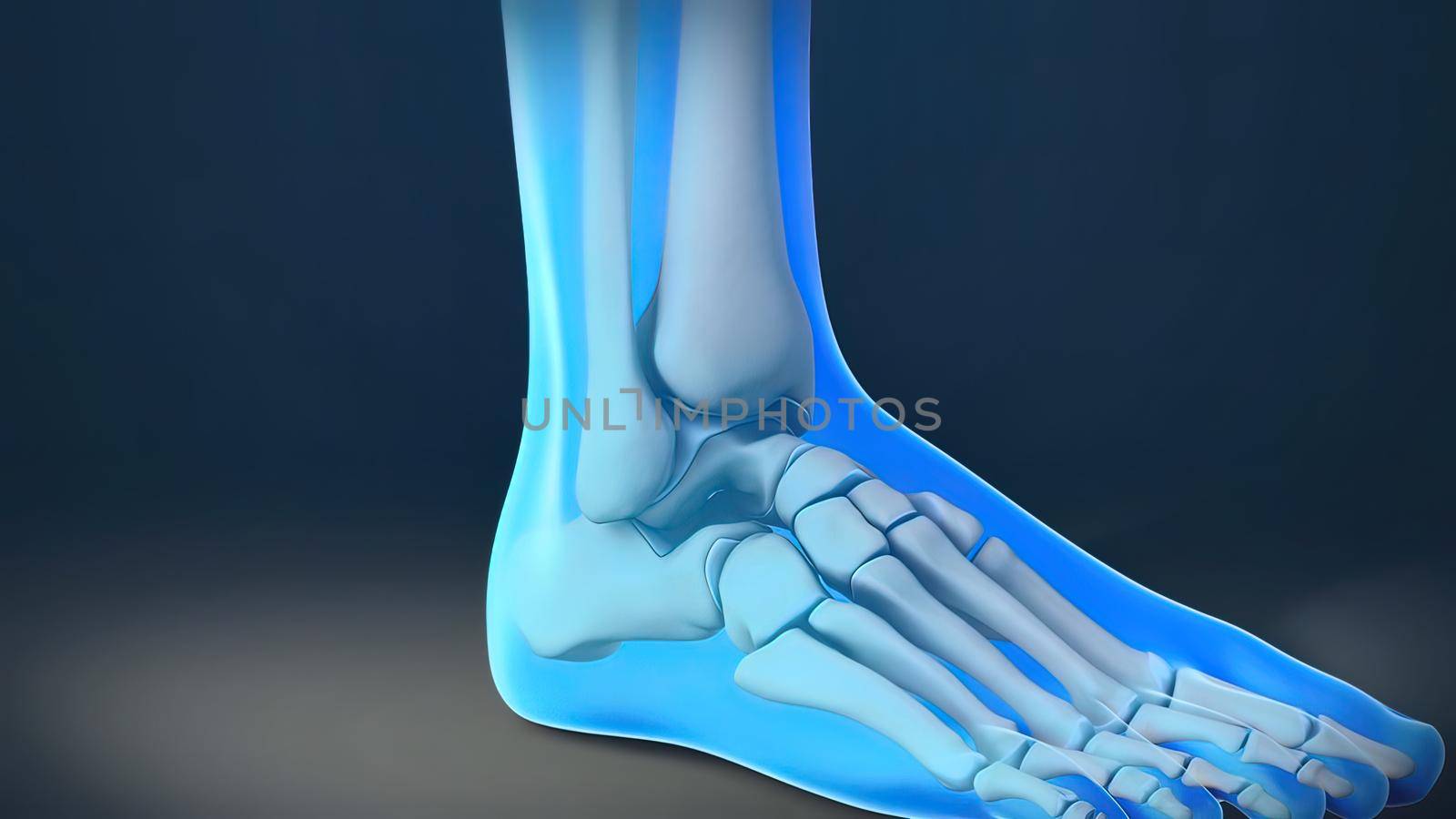 Foot and Ankle Fracture 3d medical illustration