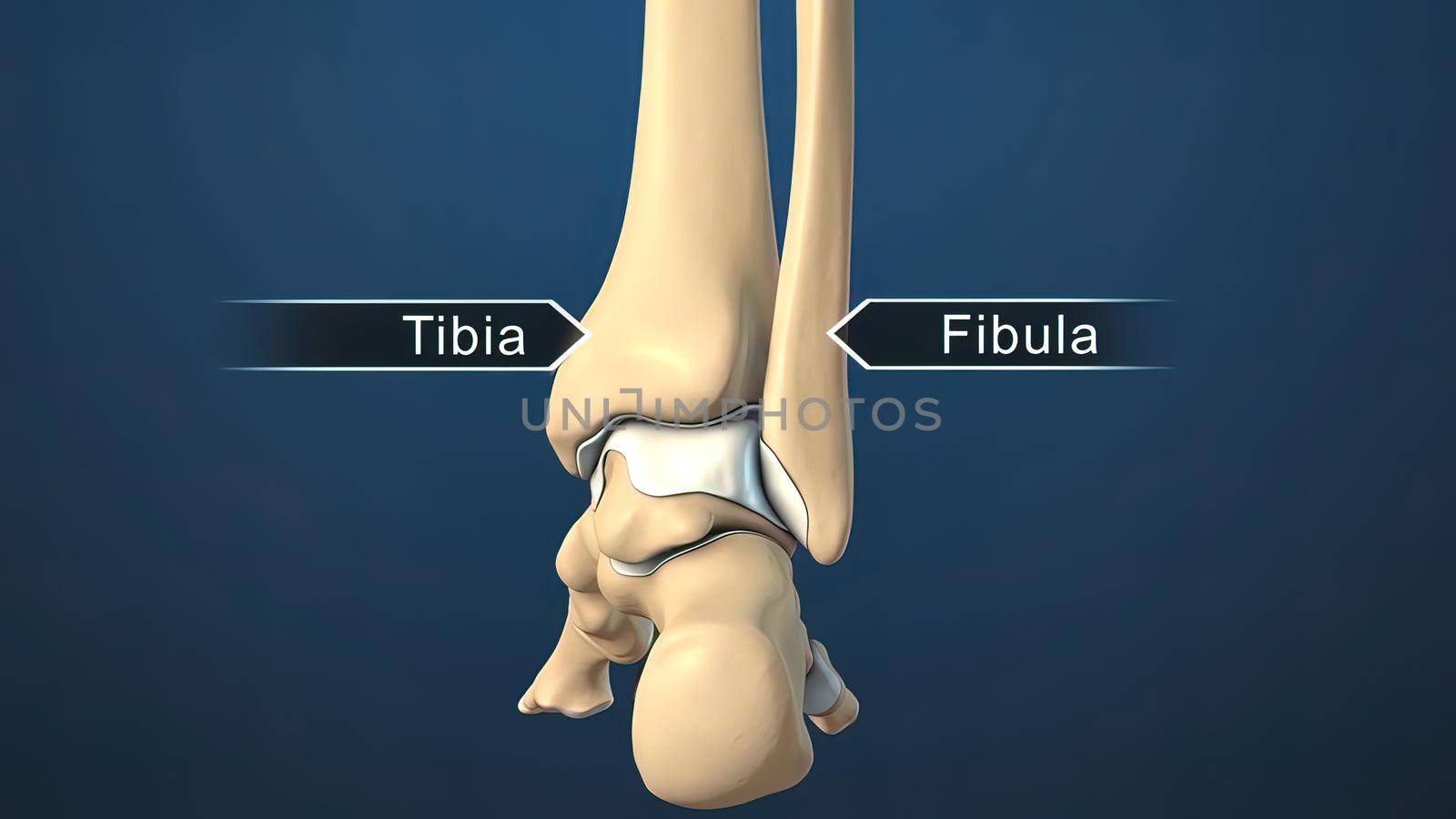 Foot and Ankle Fracture 3d medical by creativepic