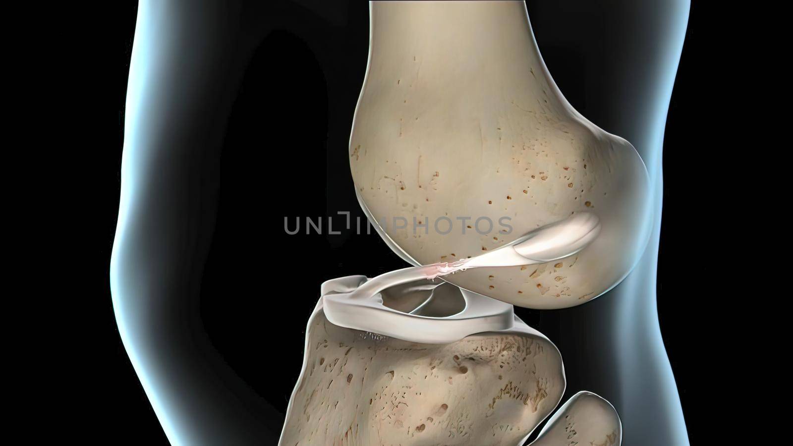 anterior cruciate ligament, the knee joint by creativepic
