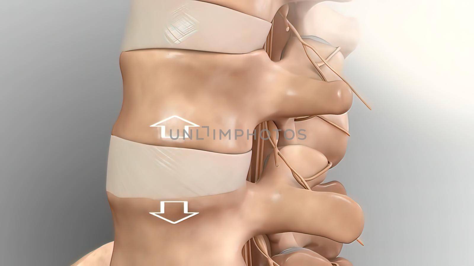 Cervical spine .Chronic Low Back Pain 3D illustration