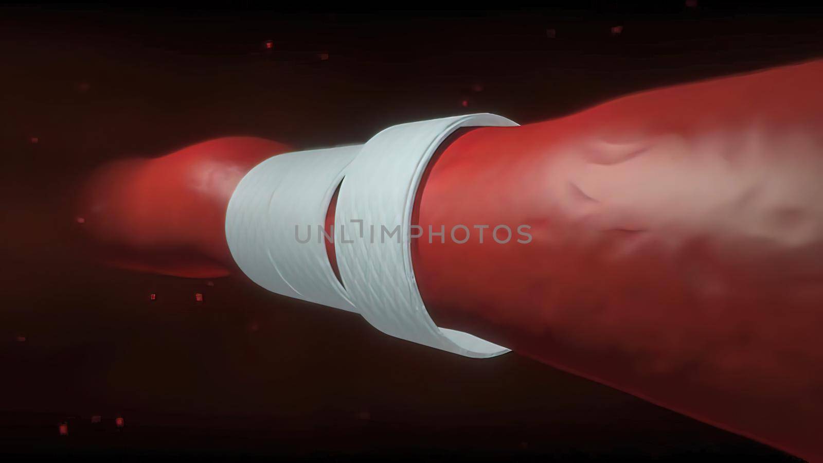 Artificial muscles are actuators 3d anatomy by creativepic