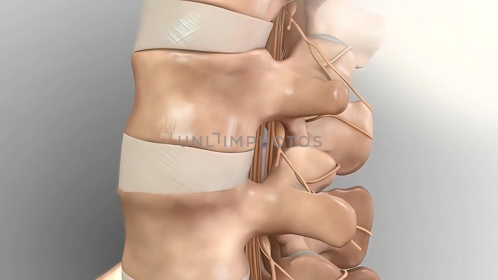 Cervical spine .Chronic Low Back Pain by creativepic
