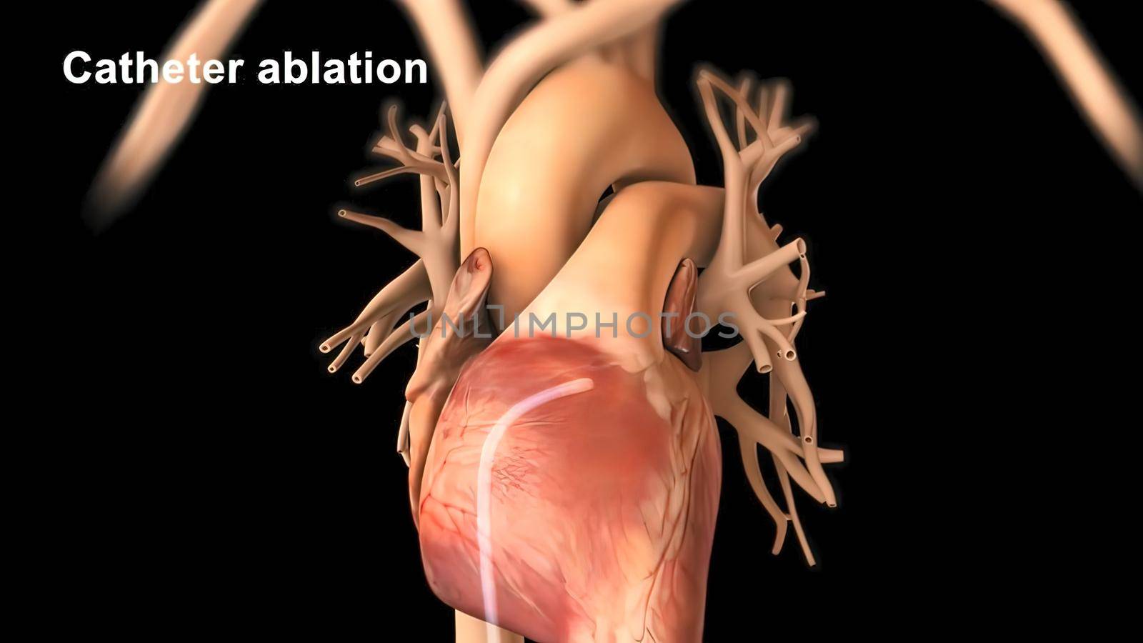 Cardiac Conduction System 3D illustration