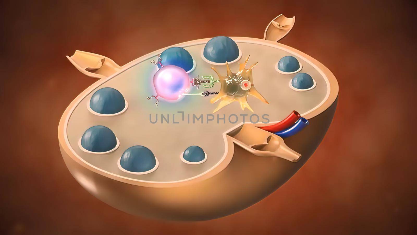 T-Cells attacking an epanding cancer cell dendritic cells attach on cancer cells immune response immunotherapy. 3D illustration