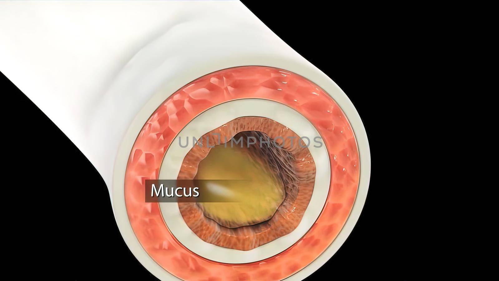 alveolar illustration in the lung .