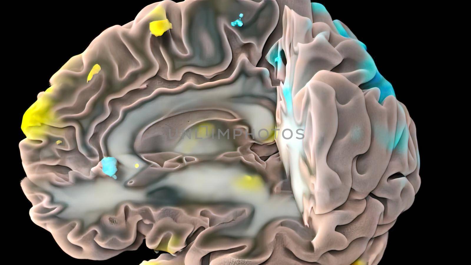 Human brain with neuronal impulses. Spinning. Loopable 3D illustration