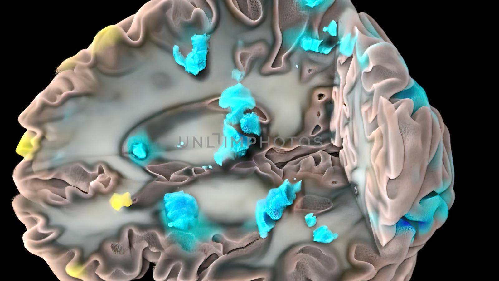 Human brain with neuronal impulses. Spinning. Loopable 3D illustration