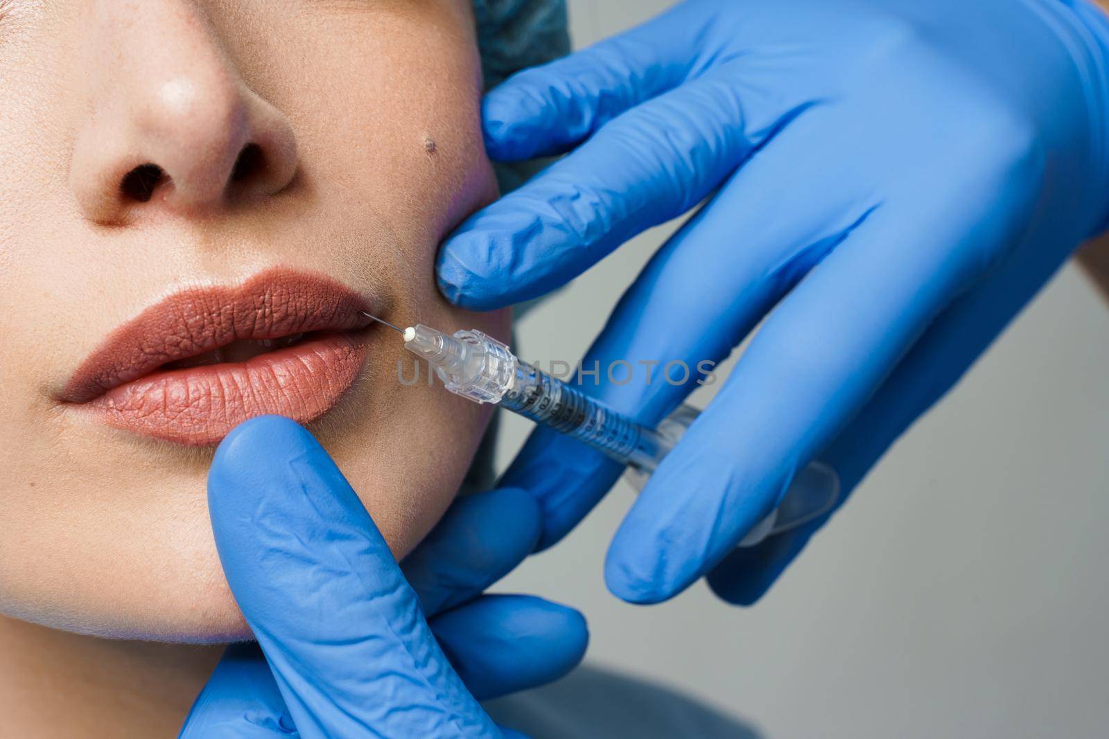 Closeup lips augmentation injections for attractive girl. Plastic surgeon does injection in lip in medical clinic.