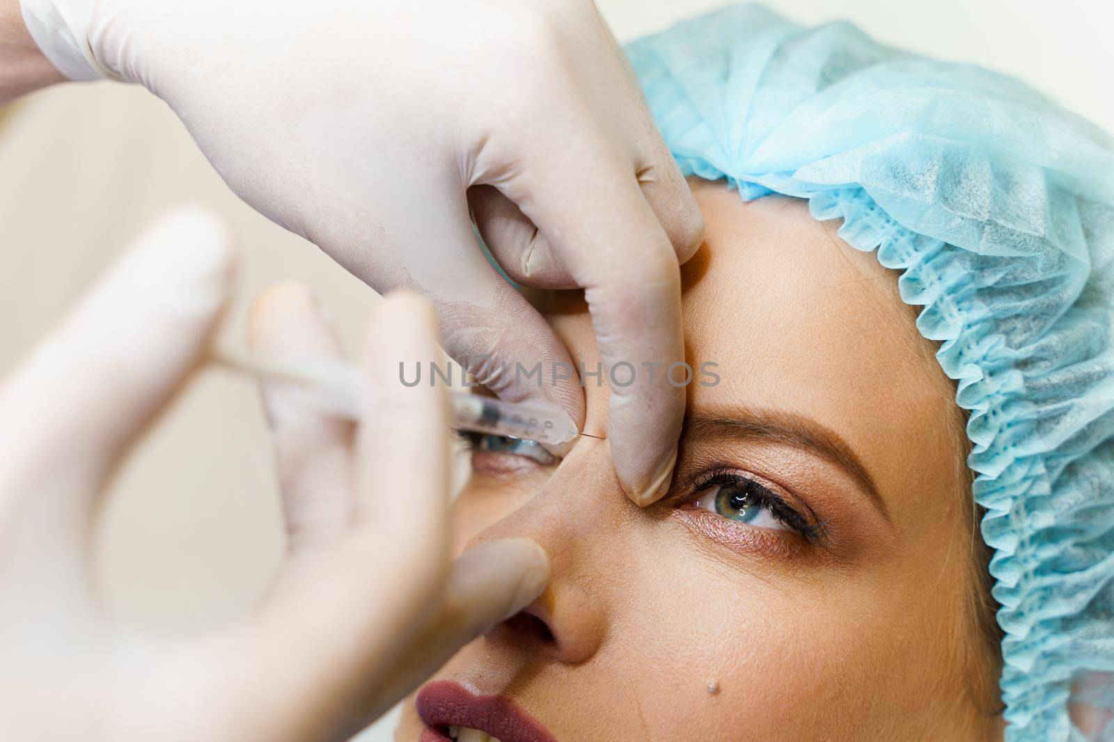 Close-up injection in nose bridge. Contour plastic for correcting the volume and shape of the glabella nose, chin, cheekbones