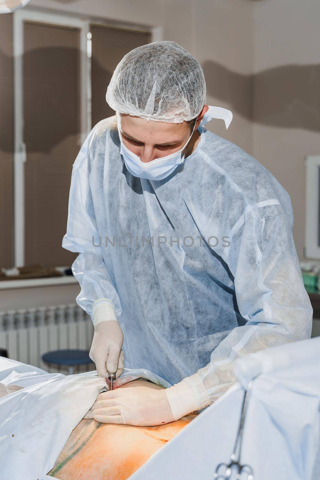 Surgeon removes fat in the gluteal region. Abdominoplasty - plastic operation to reduce the abdomen and remove cellulite by Rabizo