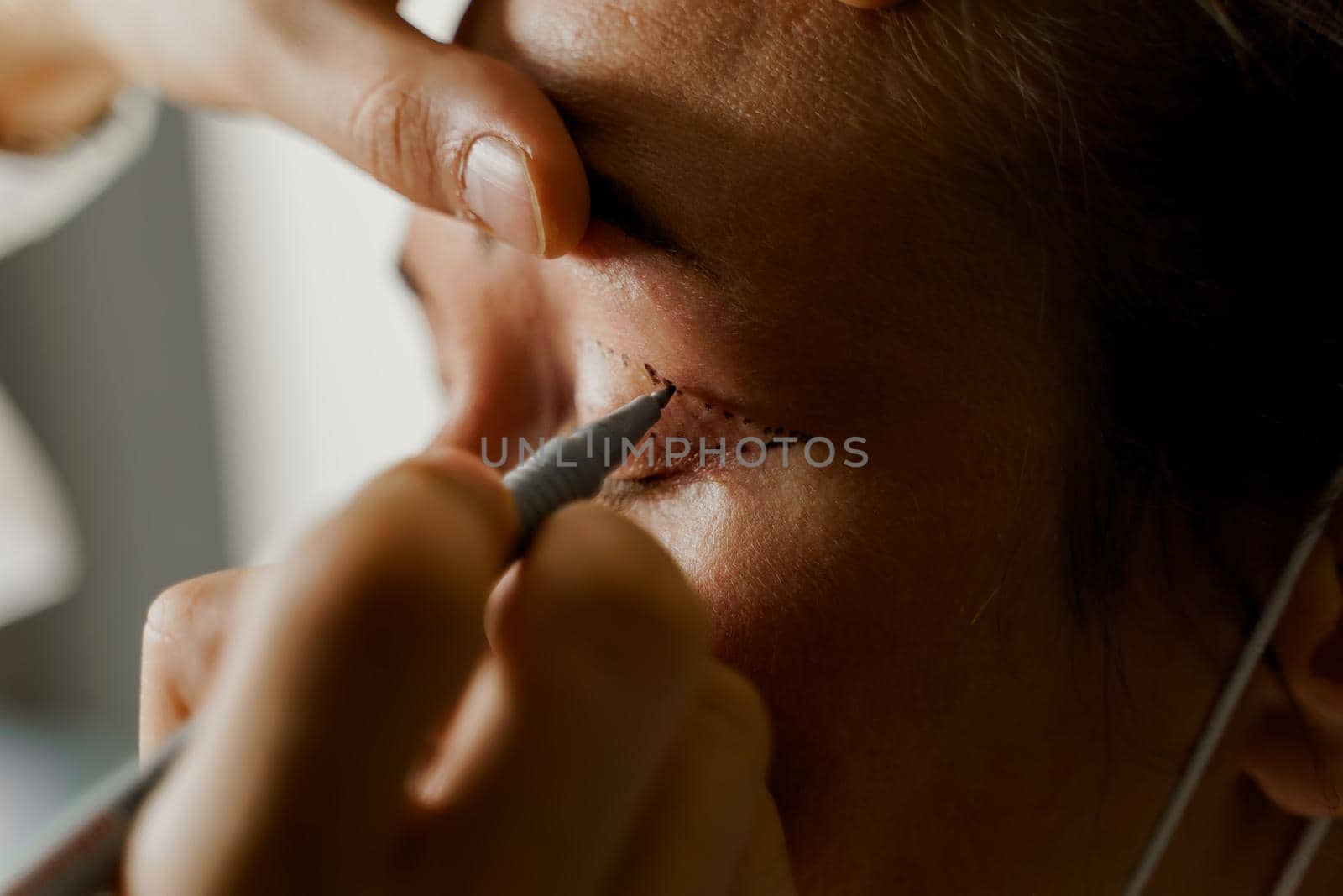 Blepharoplasty markup on the face of a beautiful female before the plastic surgery operation for modifying the eye region of the face in medical clinic. 2 doctors do plastic cosmetic operation