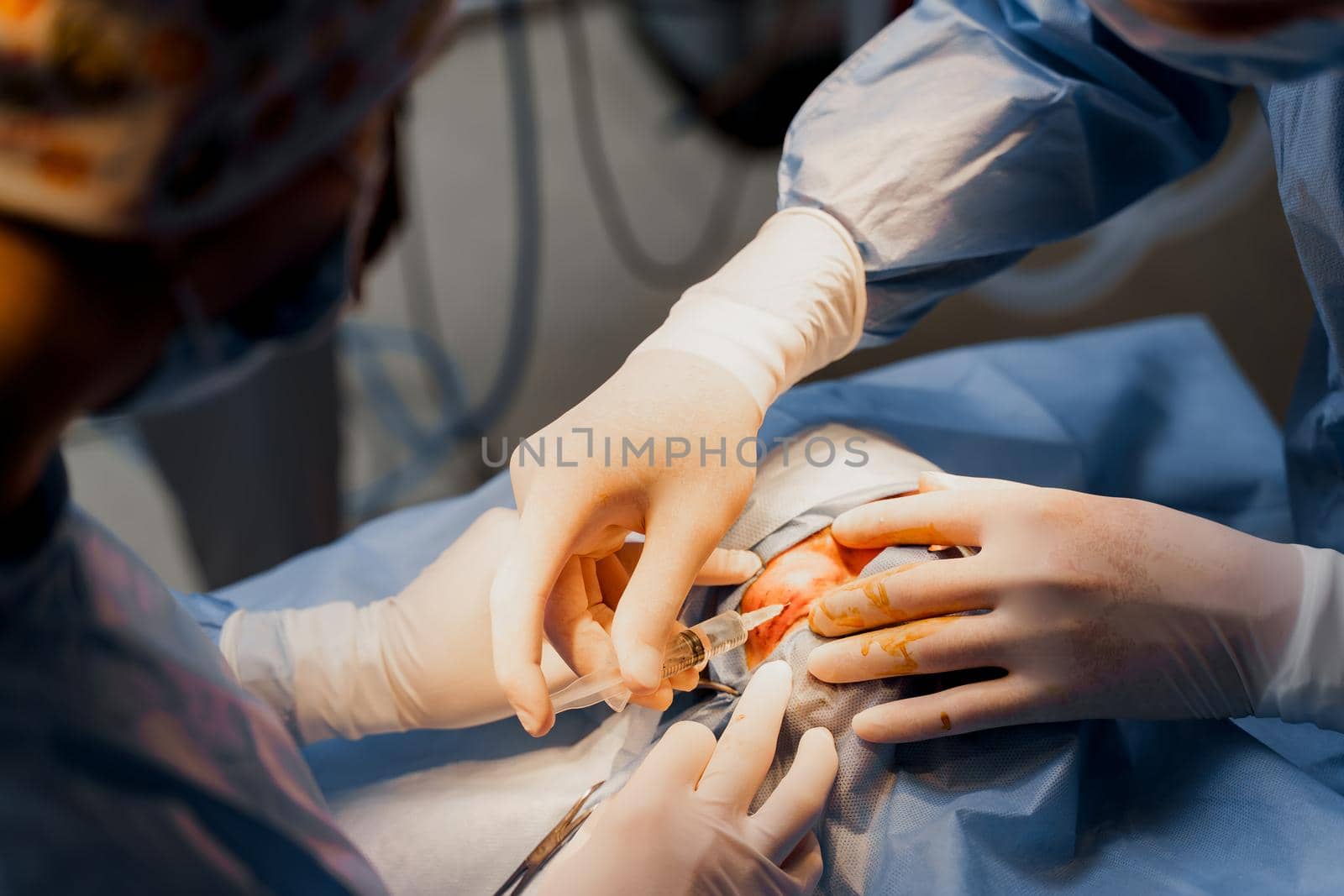 Blepharoplasty plastic surgery operation for modifying the eye region of the face in medical clinic. Surgeon makes an incision with a surgical knife