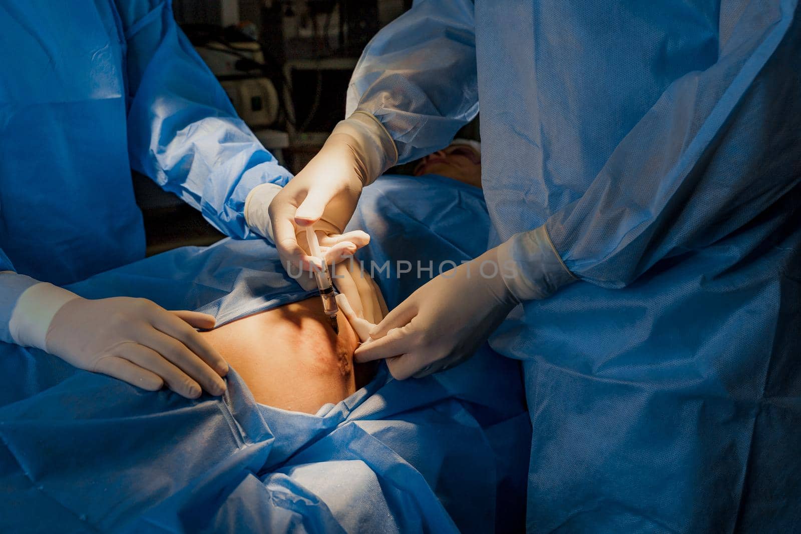 Close-up anesthesia thigh injection before blepharoplasty and lipofilling plastic surgery operation for modifying the eye region of the face