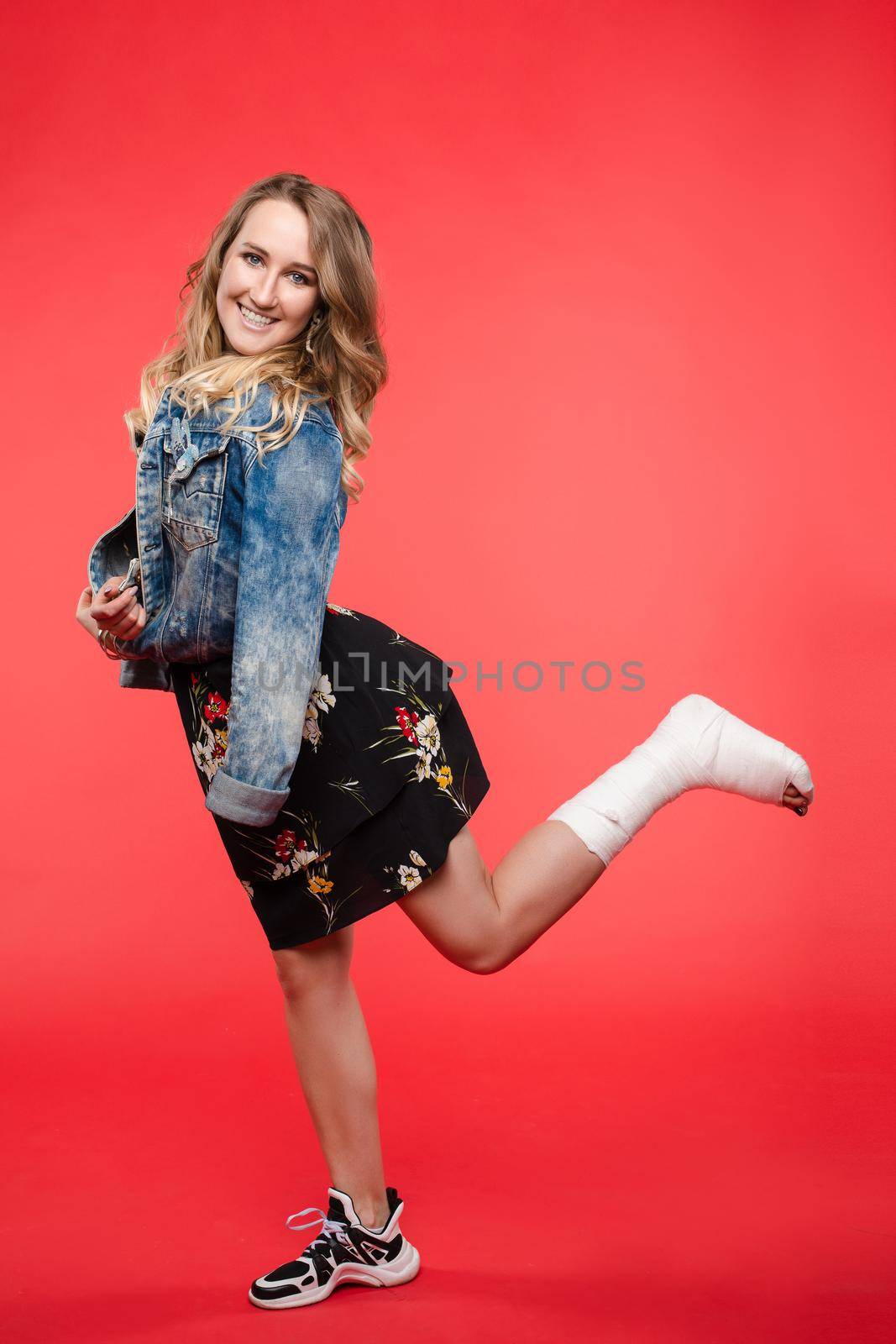 Side view of pretty woman in short dress posing with broked leg on isolated background. Happy confident model with fracture looking at camera and laughing. Concept of happiness and inquiry.