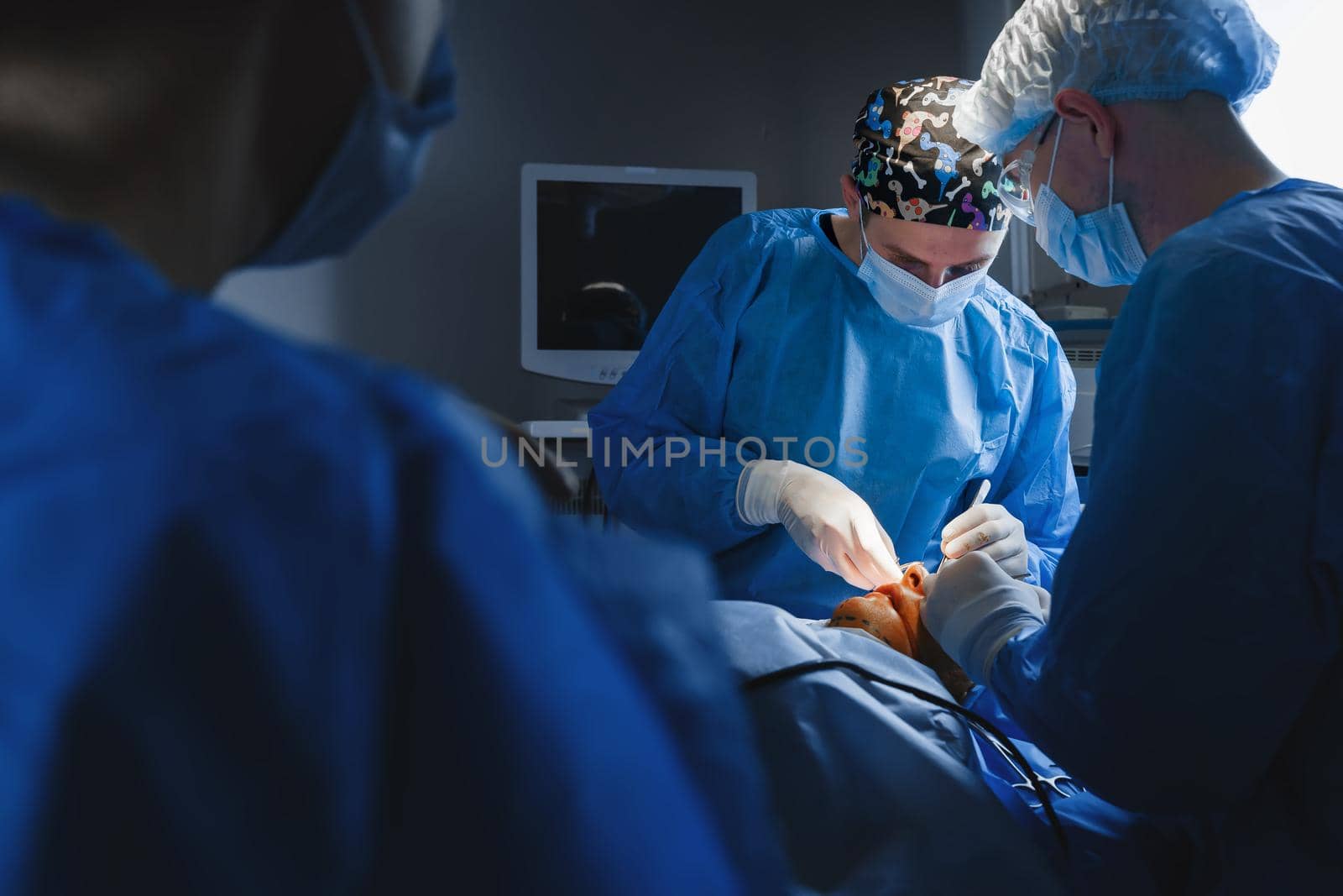 Upper blepharoplasty. Surgeon do plastic operation. 2 surgeons removing piece of skin from eyelid. Transconjunctival blepharoplasty. Surgery by Rabizo
