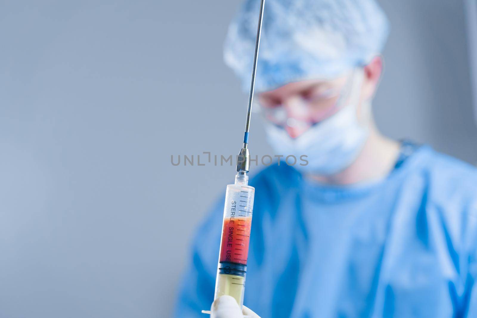 Human fat in a syringe close-up. Liposuction for lipofilling surgery operation. Plastic operation in medical clinic