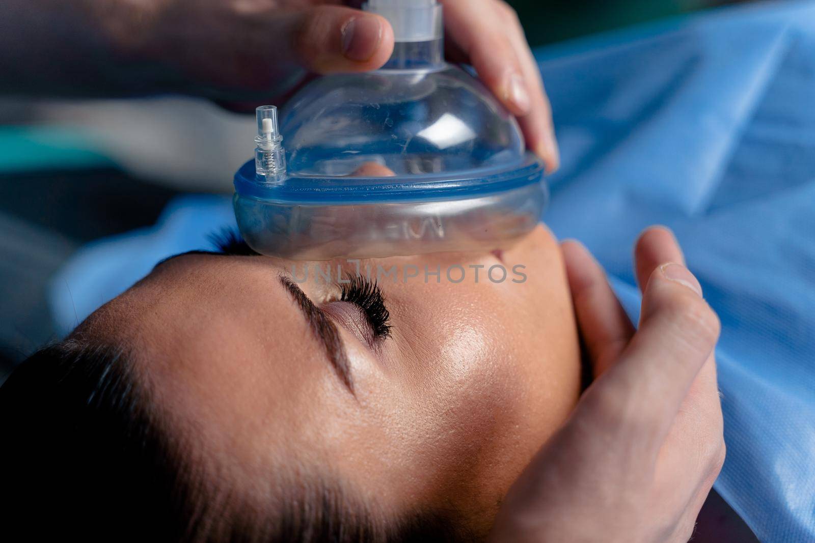 Anesthesiologist making ingalation anesthesia for patient. Doctor puts a mask on the patient before starting operation by Rabizo