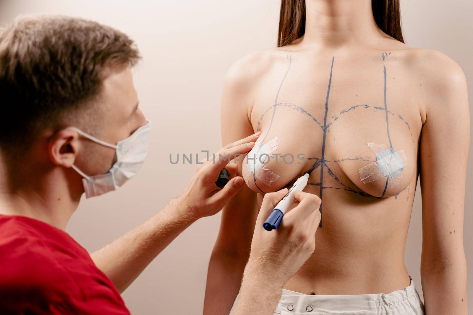 Drawing a marking line on the chest of a young girl. Breast augmentation surgery markup