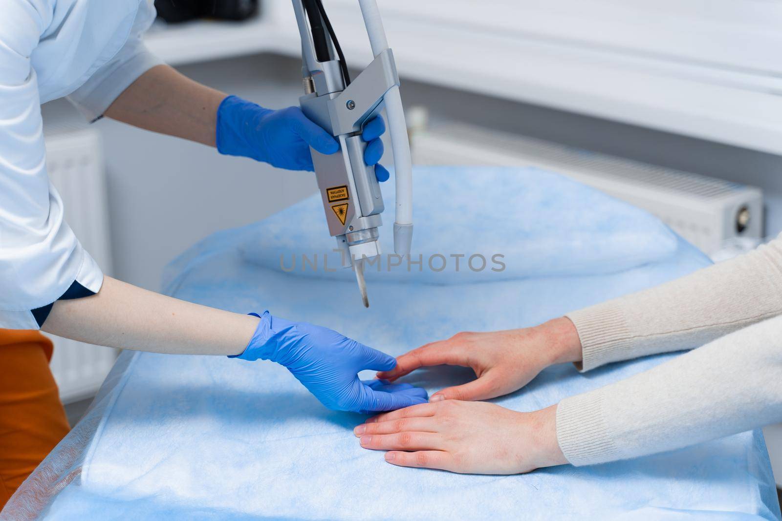 Laser treatment of onychomycosis. fungal infection on the hands of a young girl in medical clinic.