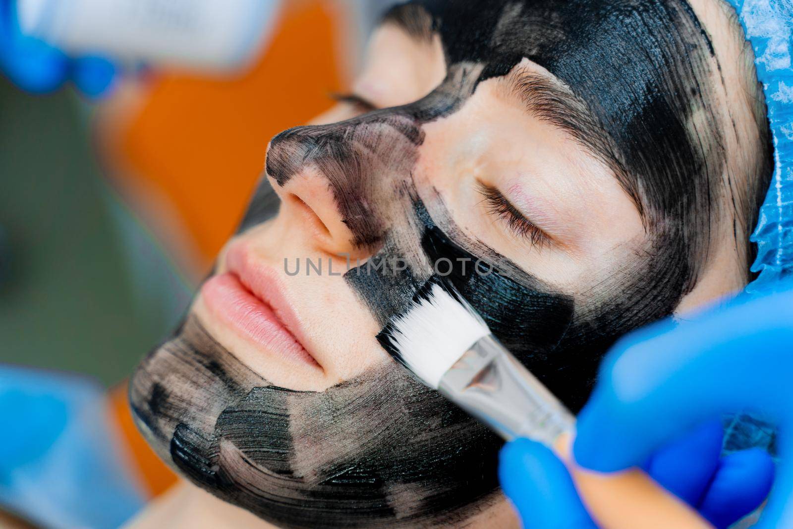 Dermatologist smears black mask on face for laser photorejuvenation and carbon peeling. Dermatology and cosmetology. Using surgical laser by Rabizo