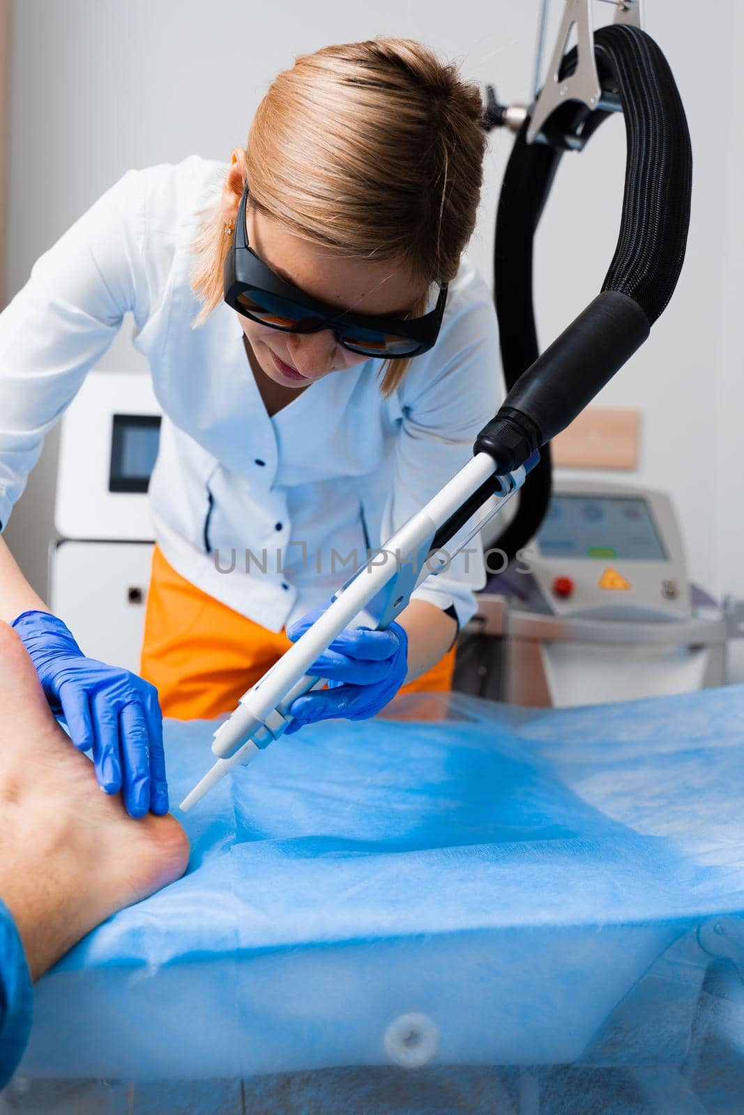 Laser removal of warts on the foot. Medical dermatological surgery in the clinic.