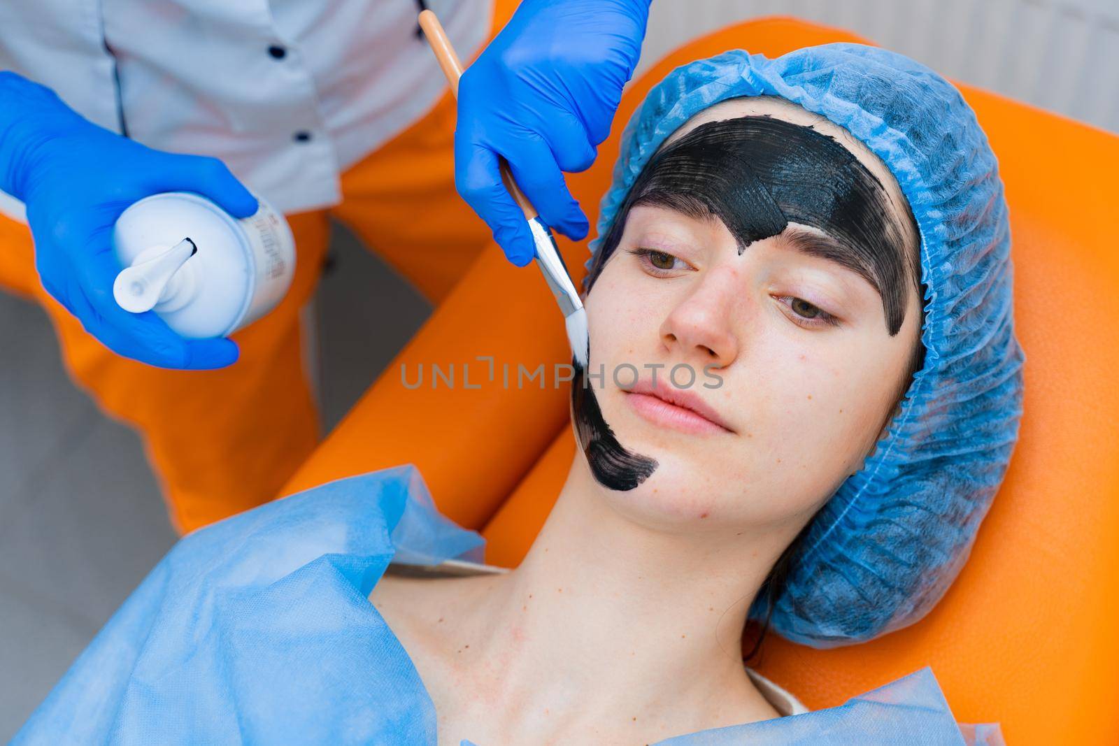 Dermatologist smears black mask on face for laser photorejuvenation and carbon peeling. Dermatology and cosmetology. Using surgical laser by Rabizo