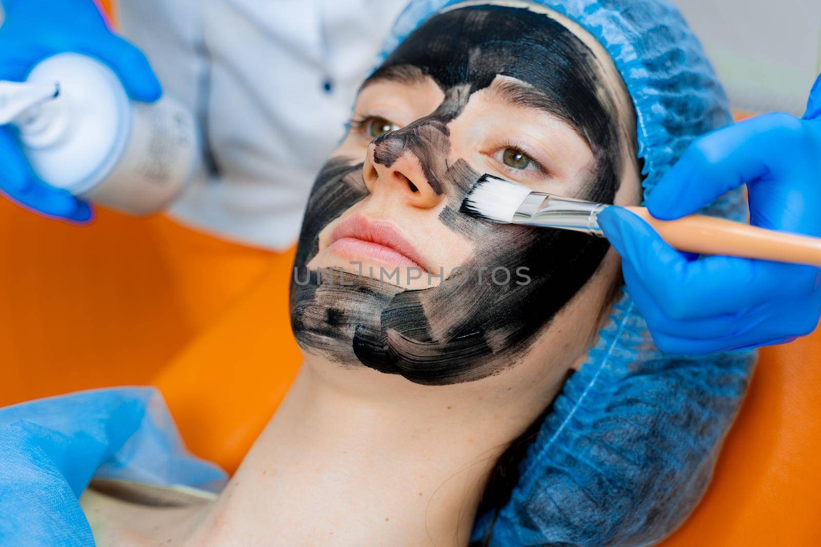 Dermatologist smears black mask on face for laser photorejuvenation and carbon peeling. Dermatology and cosmetology. Using surgical laser.