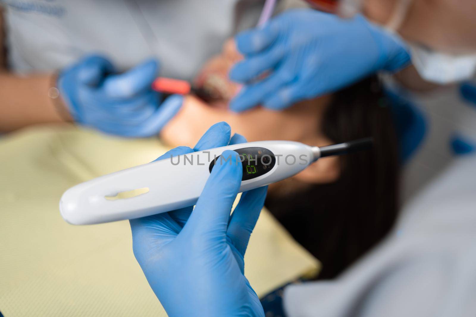 UV illumination of photopolymer tooth filling. Dentist treats and removes caries in a patient