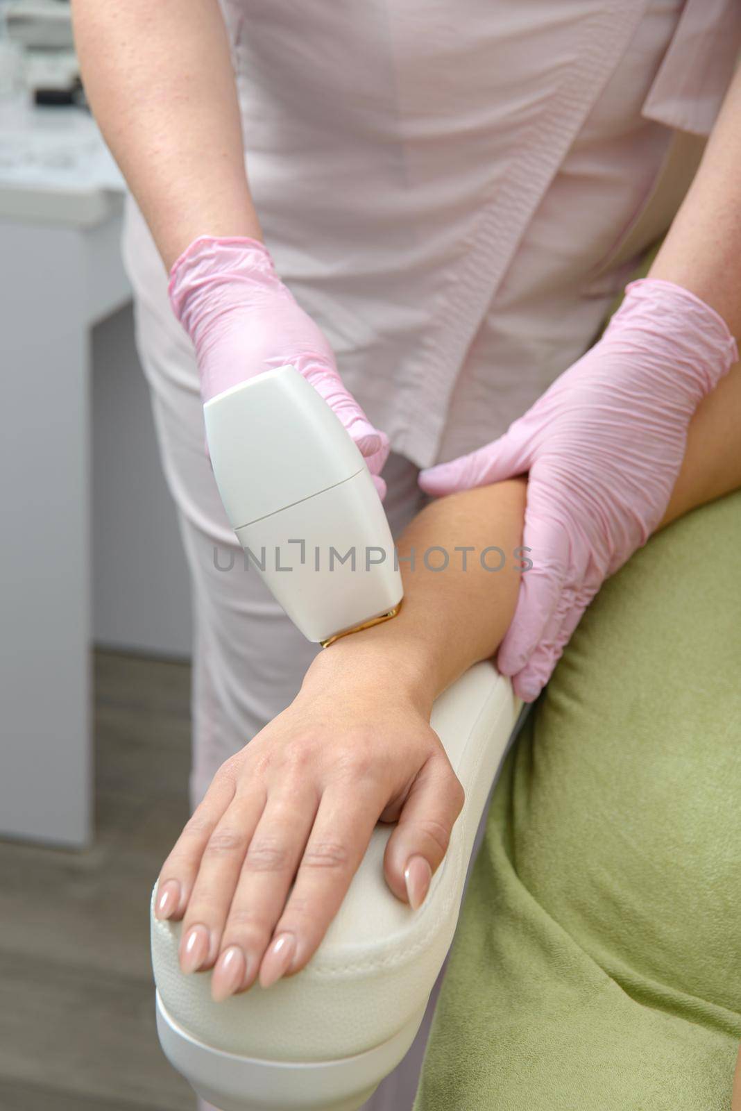 Laser hair removal procedure on ladies hand