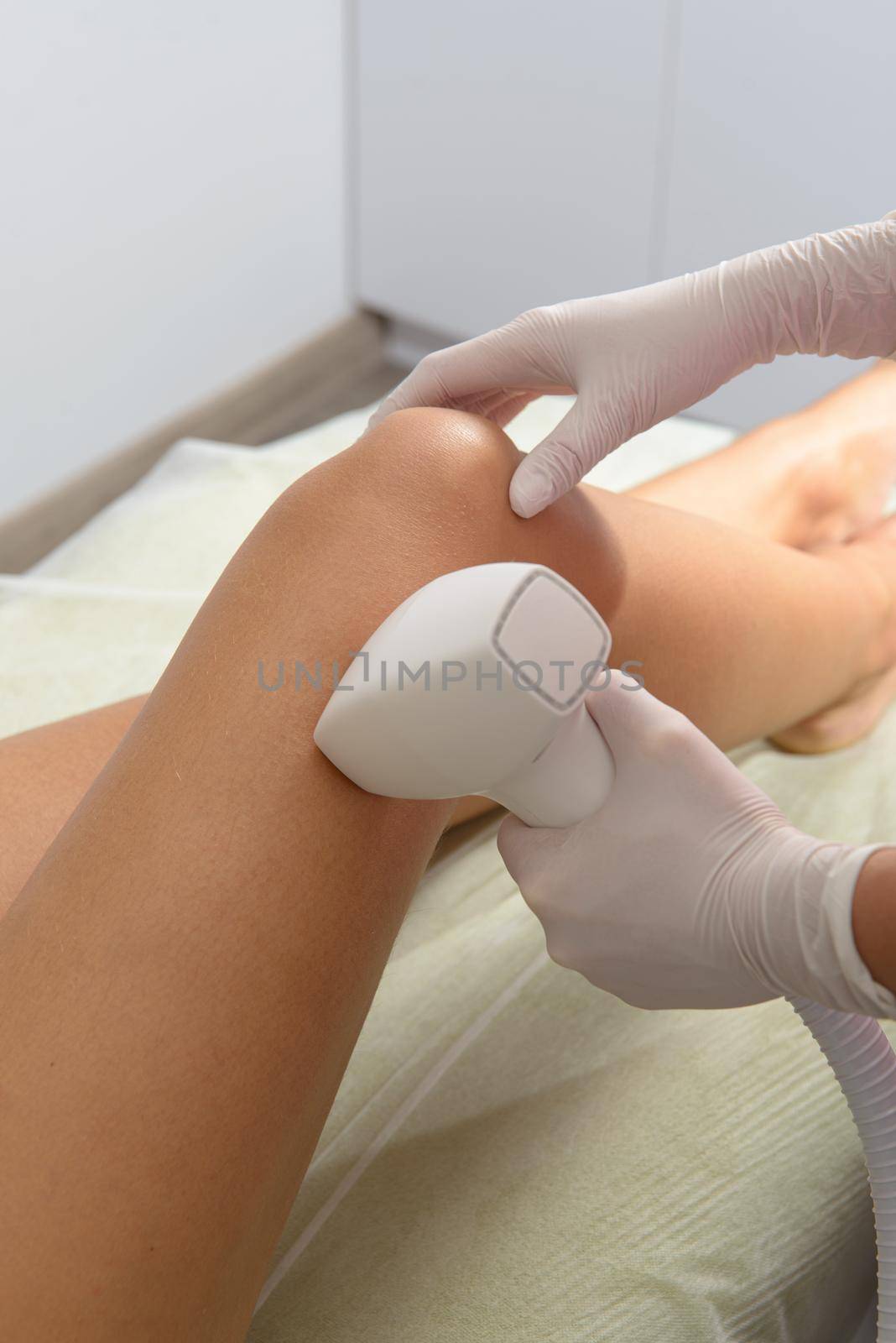 Laser hair removal procedure on ladies legs