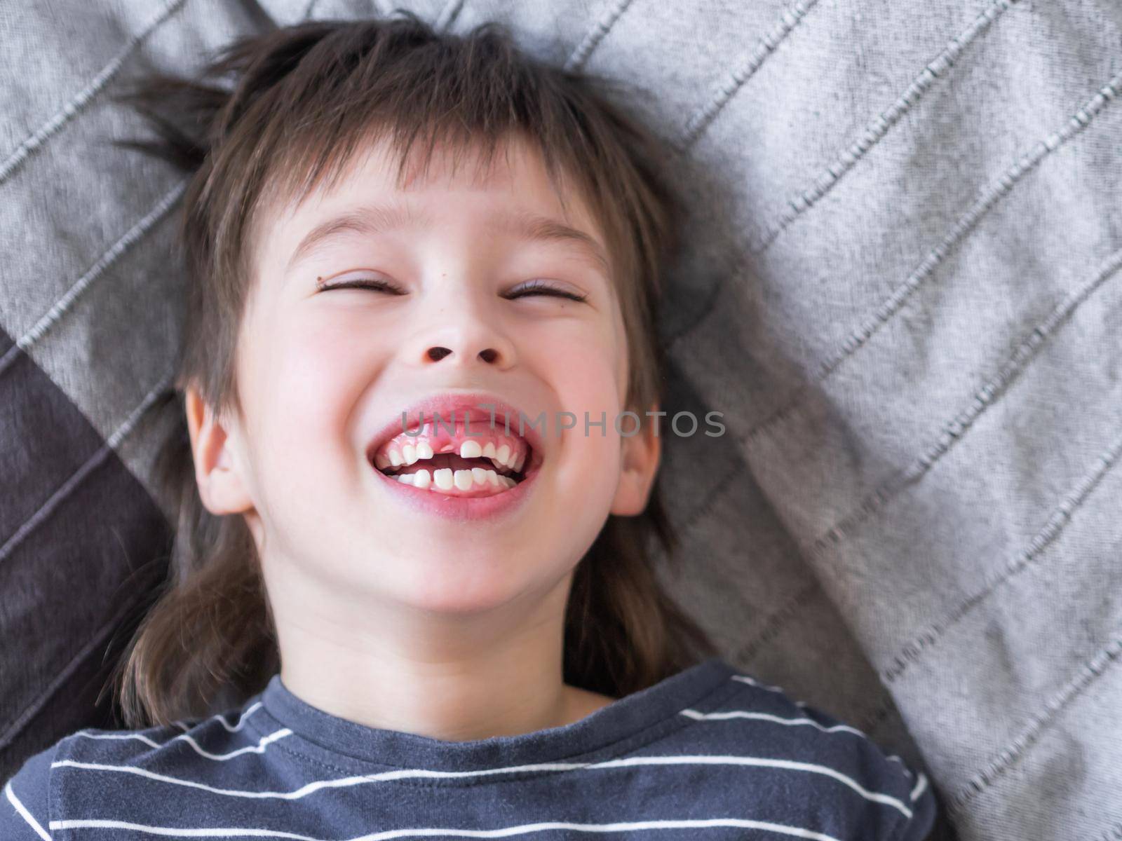 Laughing kid shows hole in row of teeth in his mouth. One incisor fell out just now. Close up photo of gums for dentist.