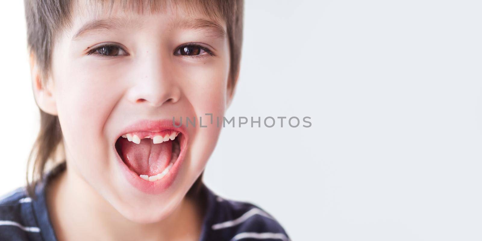 Smiling kid shows hole in row of teeth in his mouth. One incisor fell out just now. Close up photo of gums for dentist. Banner with copy space.