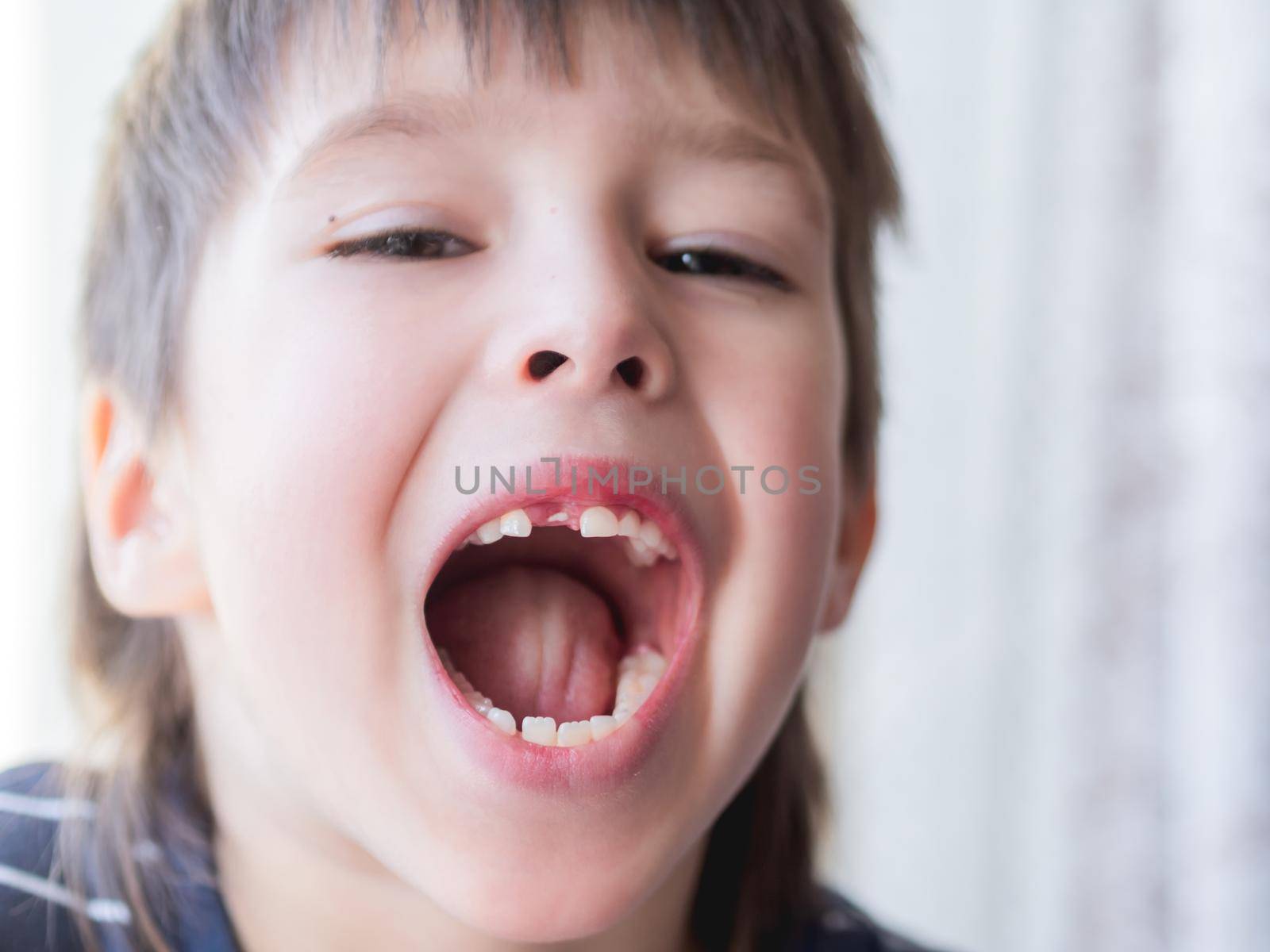 Smiling kid shows hole in row of teeth in his mouth. One incisor fell out just now. Close up photo of gums for dentist. by aksenovko