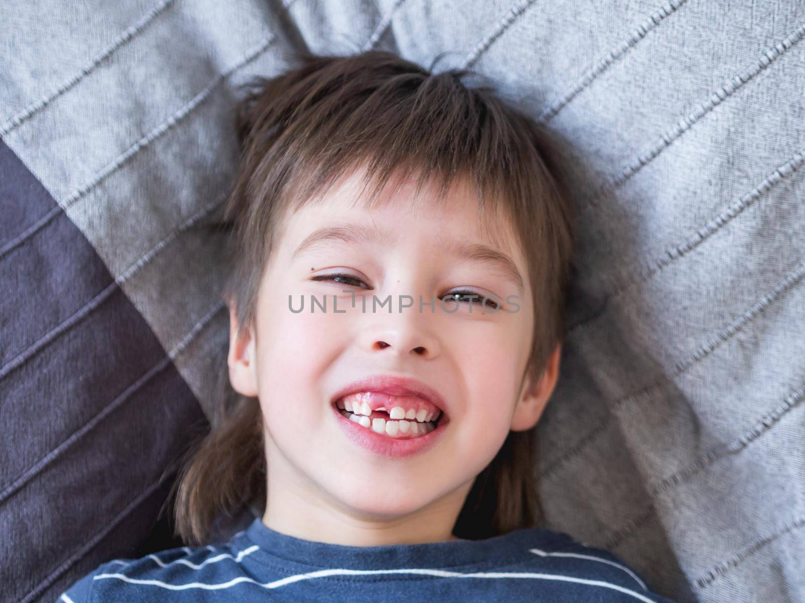 Laughing kid shows hole in row of teeth in his mouth. One incisor fell out just now. Close up photo of gums for dentist.