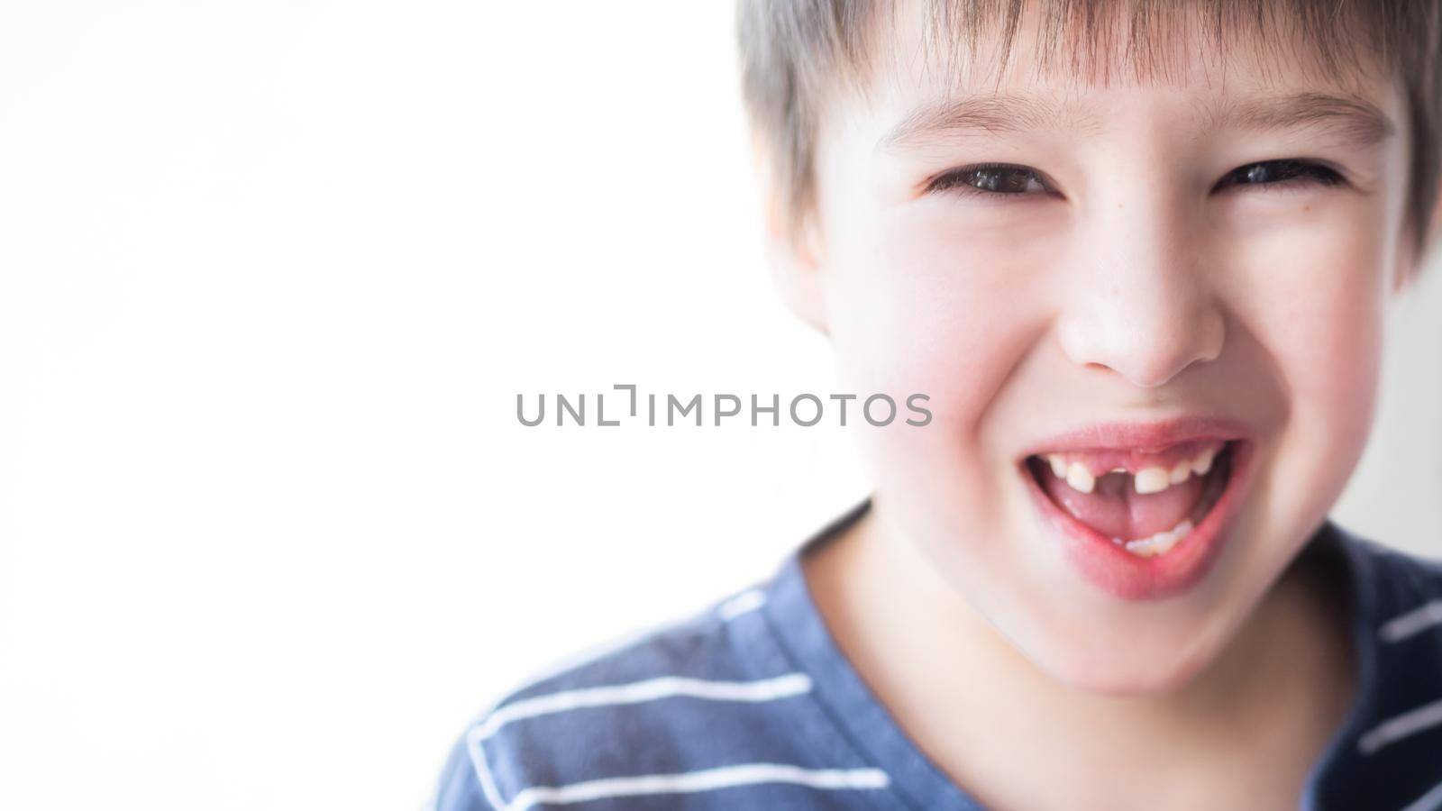 Smiling kid shows hole in row of teeth in his mouth. One incisor fell out just now. Close up photo of gums for dentist. Copy space.