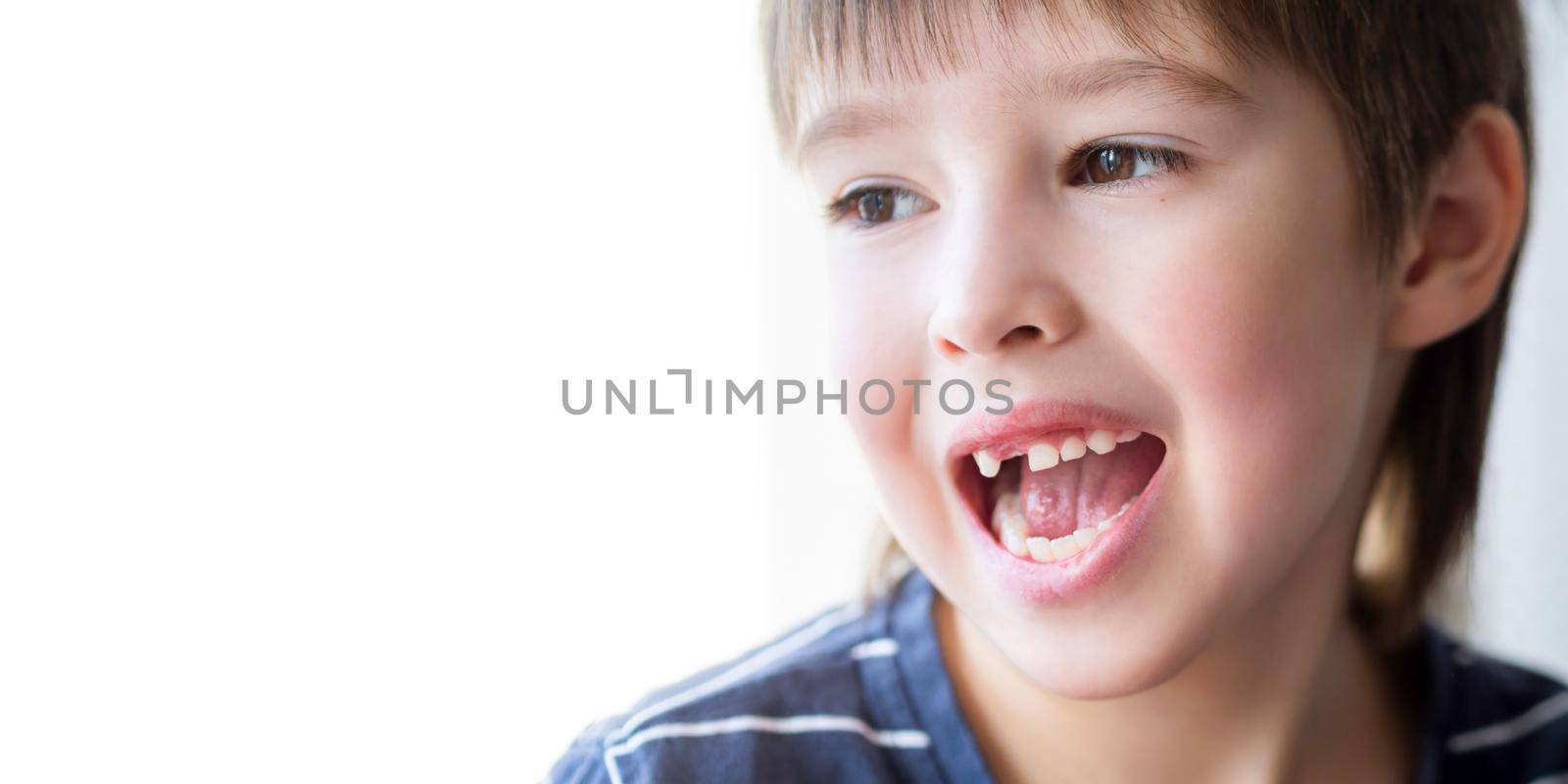 Smiling kid shows hole in row of teeth in his mouth. One incisor fell out just now. Close up photo of gums for dentist. Copy space. by aksenovko