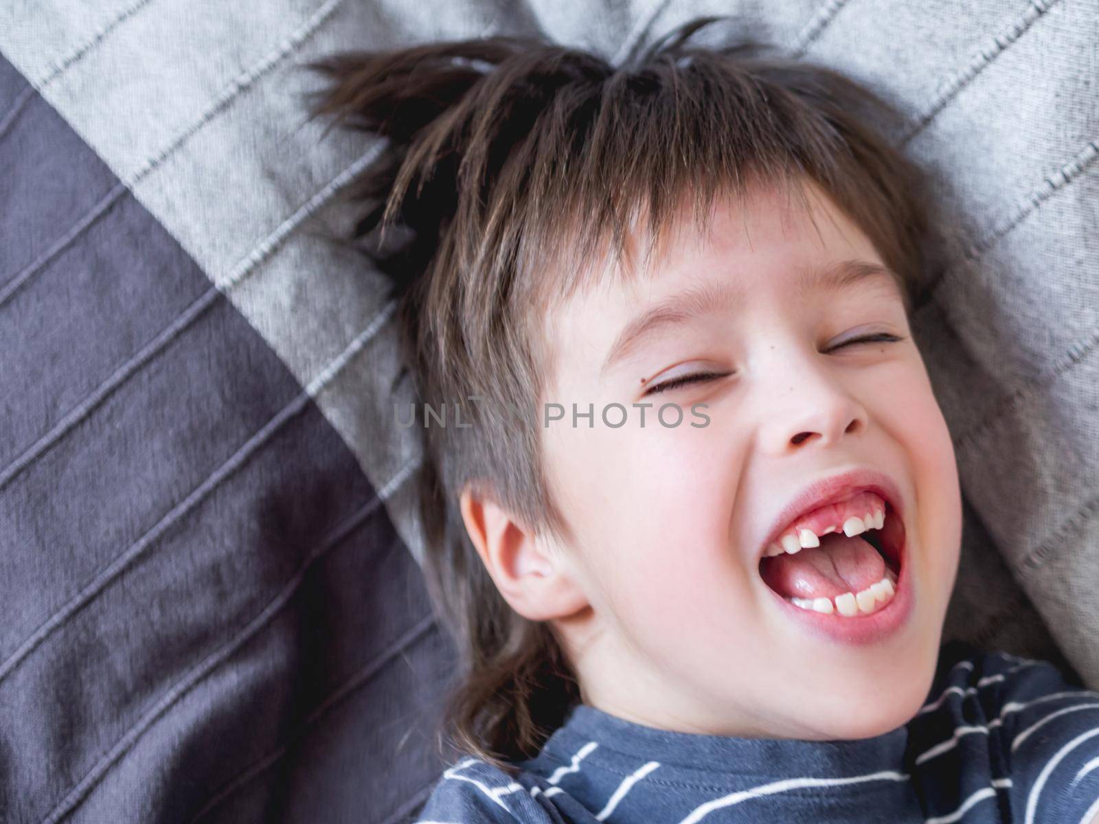 Laughing kid shows hole in row of teeth in his mouth. One incisor fell out just now. Close up photo of gums for dentist.