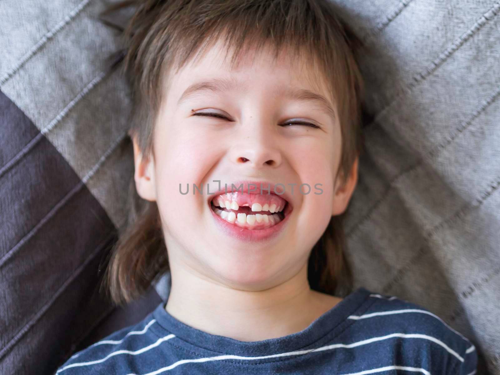 Laughing kid shows hole in row of teeth in his mouth. One incisor fell out just now. Close up photo of gums for dentist. by aksenovko