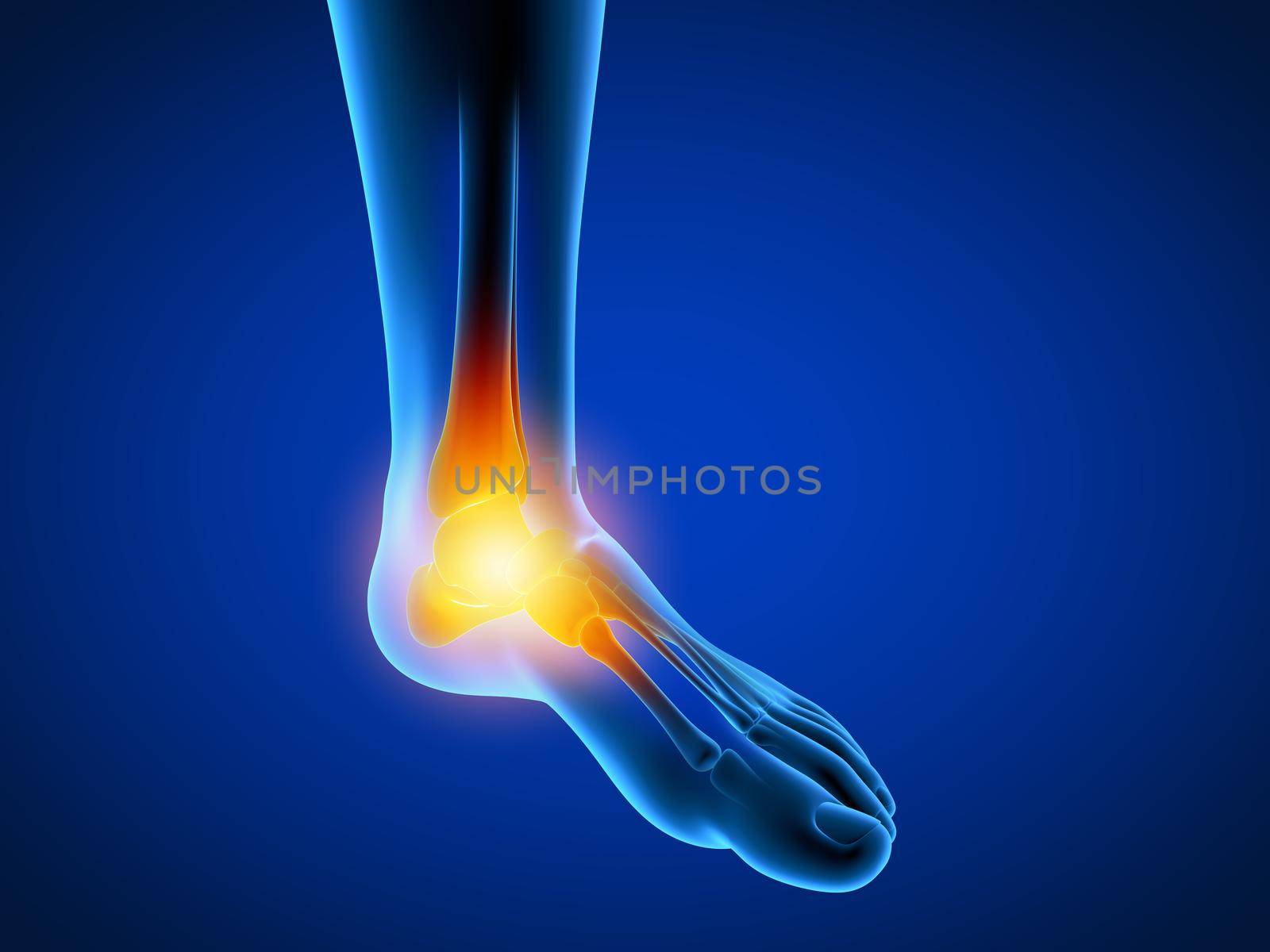 3d rendered medically accurate illustration of a man having a painful foot.