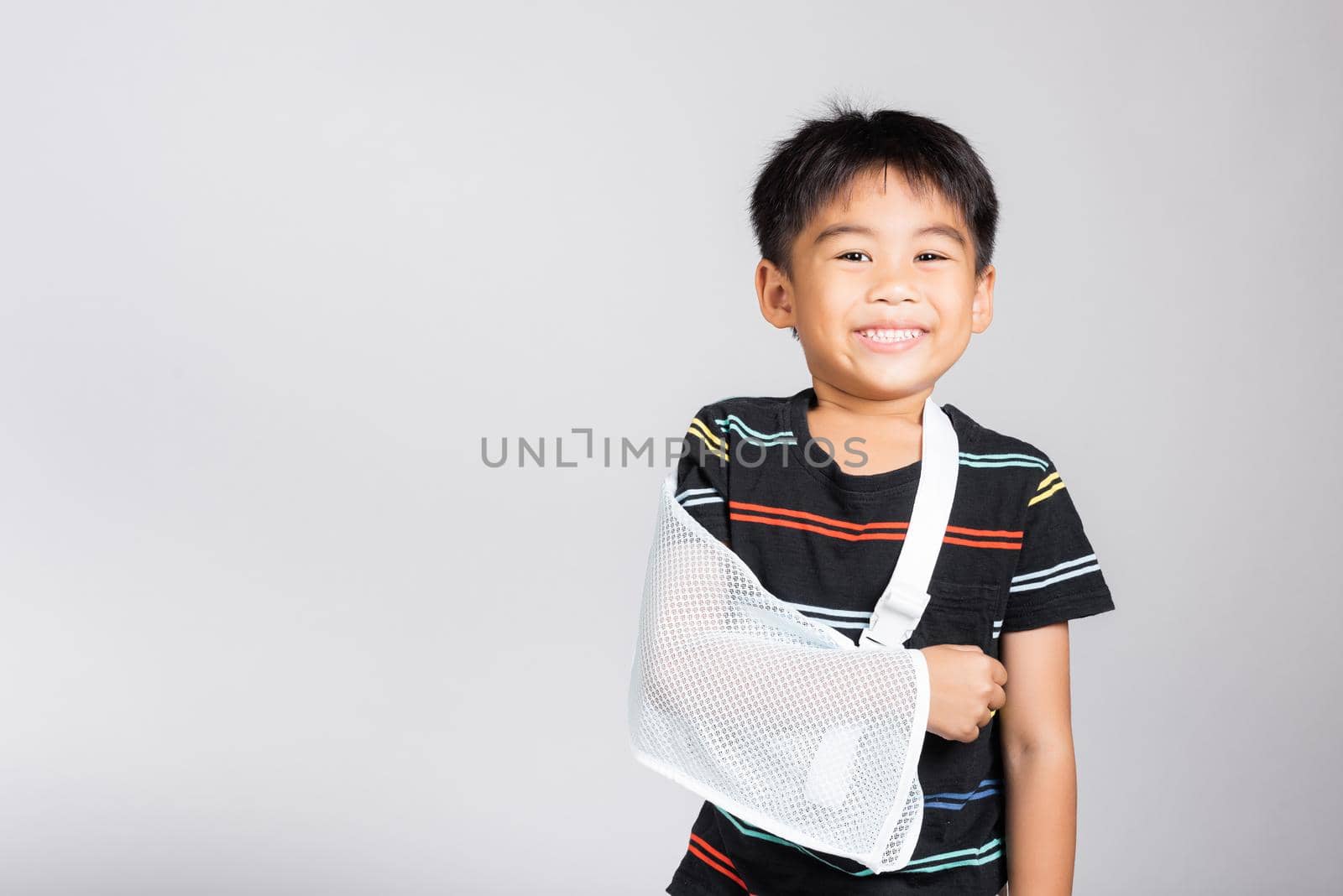 Arm broken. Little cute kid boy 5-6 years old hand bone broken from accident with arm splint in studio shot isolated on white background, Asian children preschool injured after accident, health concept