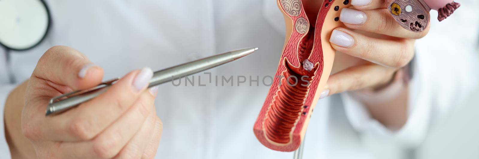 Doctor gynecologist showing pen on plastic model of uterus and ovaries closeup by kuprevich
