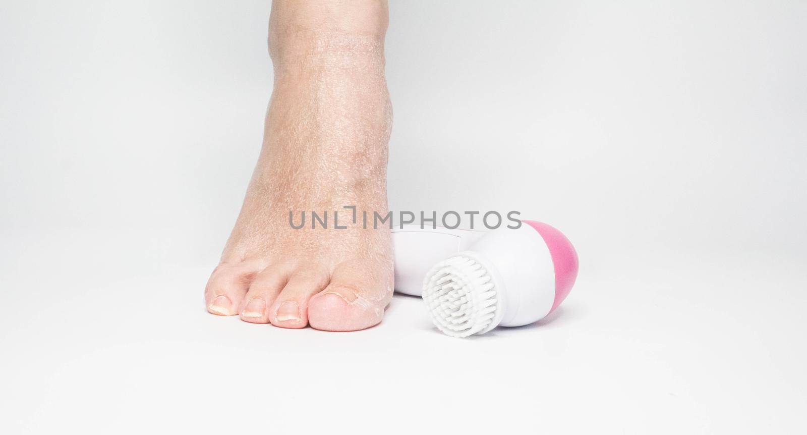 Beautiful barefoot female dry skin feet with a set of the pedicure tools by JuliaDorian